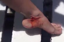 tubarão, Florida, Estados Unidos, Molly Cavalli, dentada, mordida, tornozelo