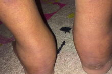 Maltrata, deixa filho à fome e dá-o de comer aos porcos