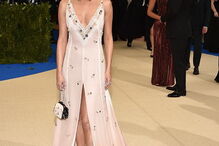 celebridades, doença, Lúpus, Selena Gomez 
