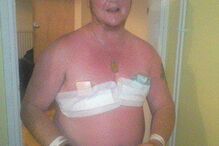 Lee Carter após a cirurgia de mudança de sexo