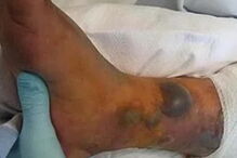 Faz tatuagem e morre após mergulho no mar