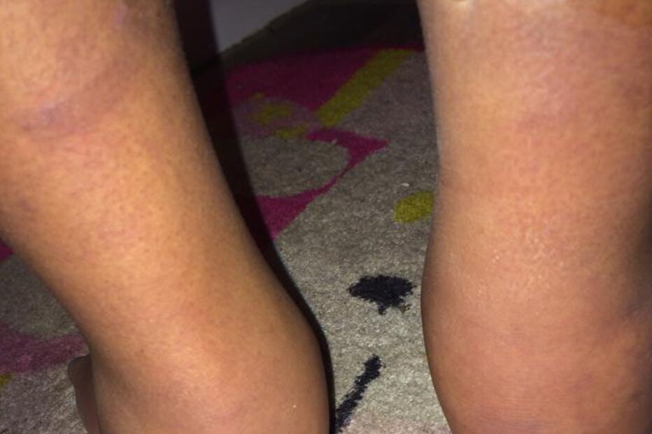 Maltrata, deixa filho à fome e dá-o de comer aos porcos