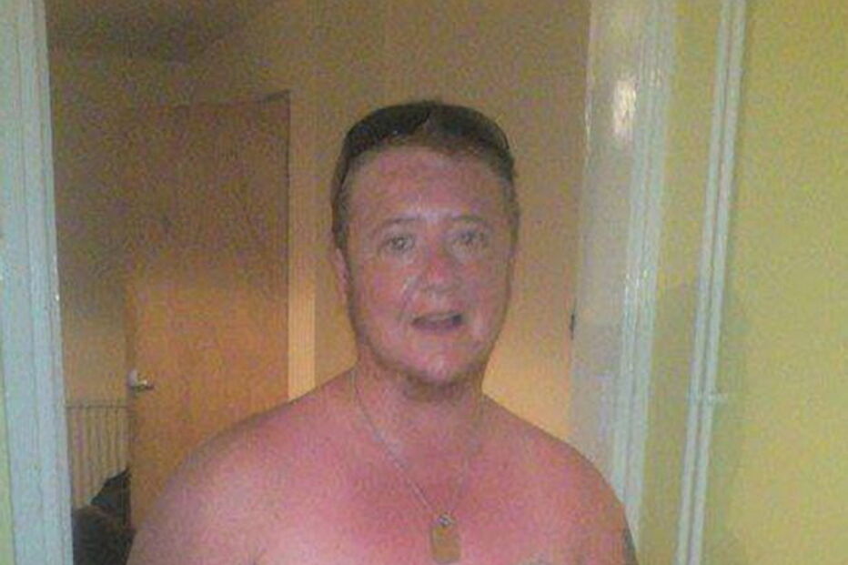 Lee Carter após a cirurgia de mudança de sexo