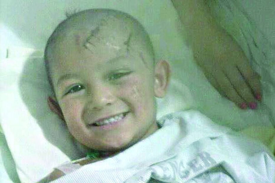 Lucas caiu de uma altura de cerca de sete metros no dia 3 de março de 2013