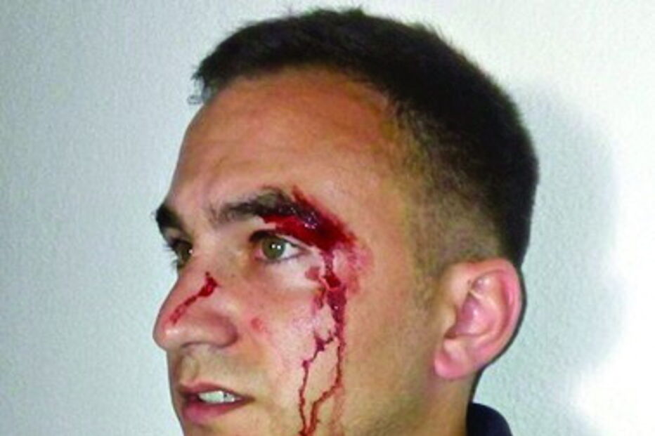 Agente Carlos Lucas foi agredido 