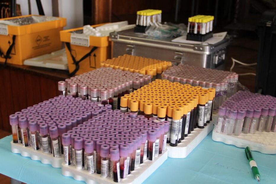 Transplante de medula óssea