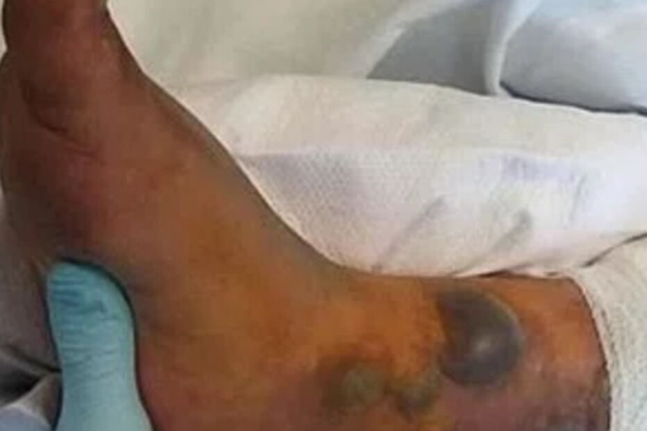 Faz tatuagem e morre após mergulho no mar