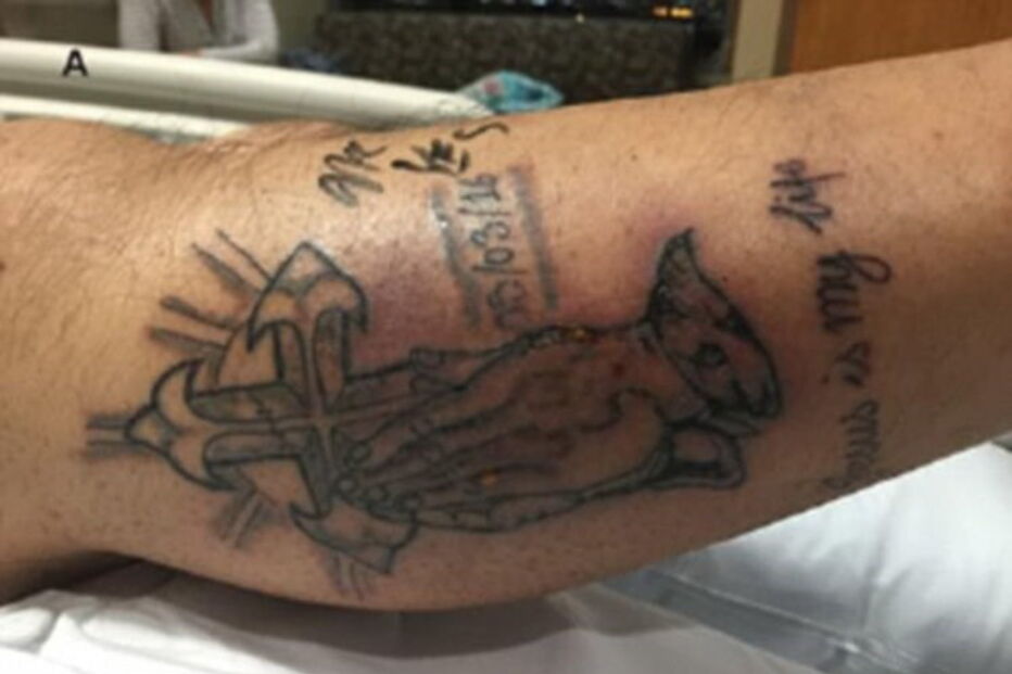 Faz tatuagem e morre após mergulho no mar