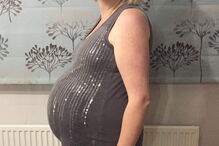 Alimenta filhas gémeas só com um peito após ter cancro da mama