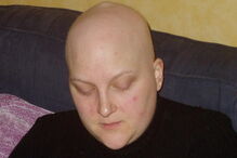 Alimenta filhas gémeas só com um peito após ter cancro da mama