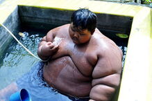 Arya Permana, saúde, Omni, Jacarta, 192 quilos, obsidade , médico, obesidade, Indonésia, pesado