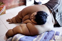 Arya Permana, saúde, Omni, Jacarta, 192 quilos, obsidade , médico, obesidade, Indonésia, pesado