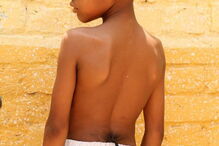 menino macaco, Índia, 