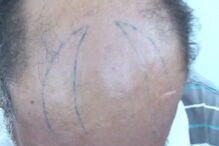 2017-06-09_10_34.28 Capture.PNG