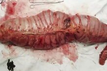 2017-06-10_12_28.02 intestino grosso 1.PNG