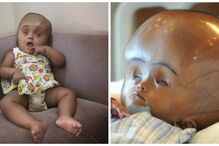 Roona Begum já tinha sido operada várias vezes