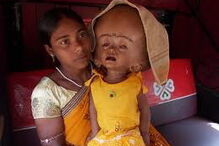 Roona Begum já tinha sido operada várias vezes