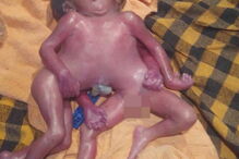 Suresh Saw, Índia, Savita Devi, Doutor Mukesh Kumar, questões sociais, saúde