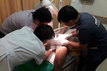 Wirat, Pattaya, Tailândia, Hospital, questões sociais, pénis, anéis, metal, órgão sexual