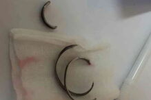 Wirat, Pattaya, Tailândia, Hospital, questões sociais, pénis, anéis, metal, órgão sexual