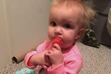 Menina com síndrome de cabelo despenteado 