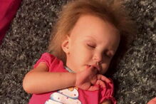 Menina com síndrome de cabelo despenteado 