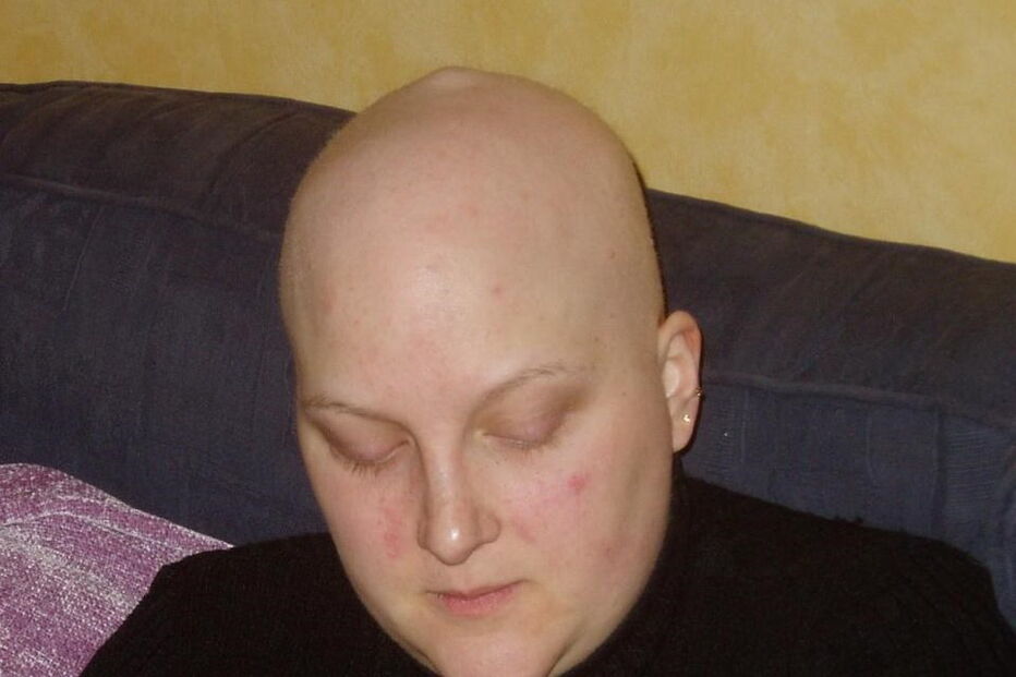 Alimenta filhas gémeas só com um peito após ter cancro da mama