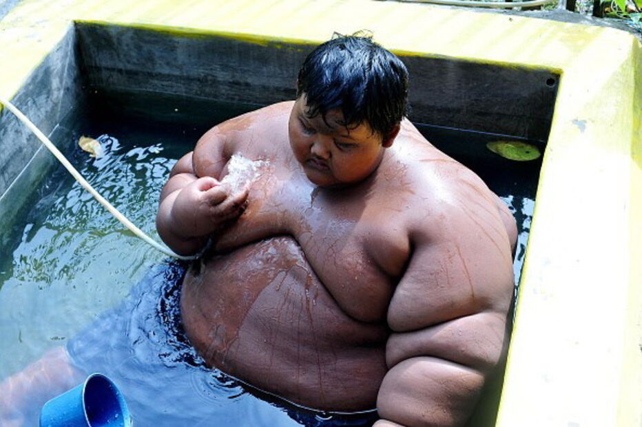 Arya Permana, saúde, Omni, Jacarta, 192 quilos, obsidade , médico, obesidade, Indonésia, pesado