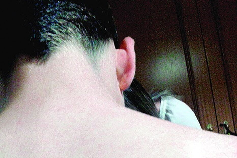 Fotos mostram marcas de golpes com cinto e queimaduras nos braços do aluno de 10 anos dos Pupilos do Exército