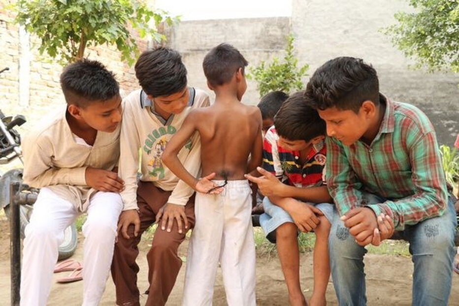 menino macaco, Índia, 