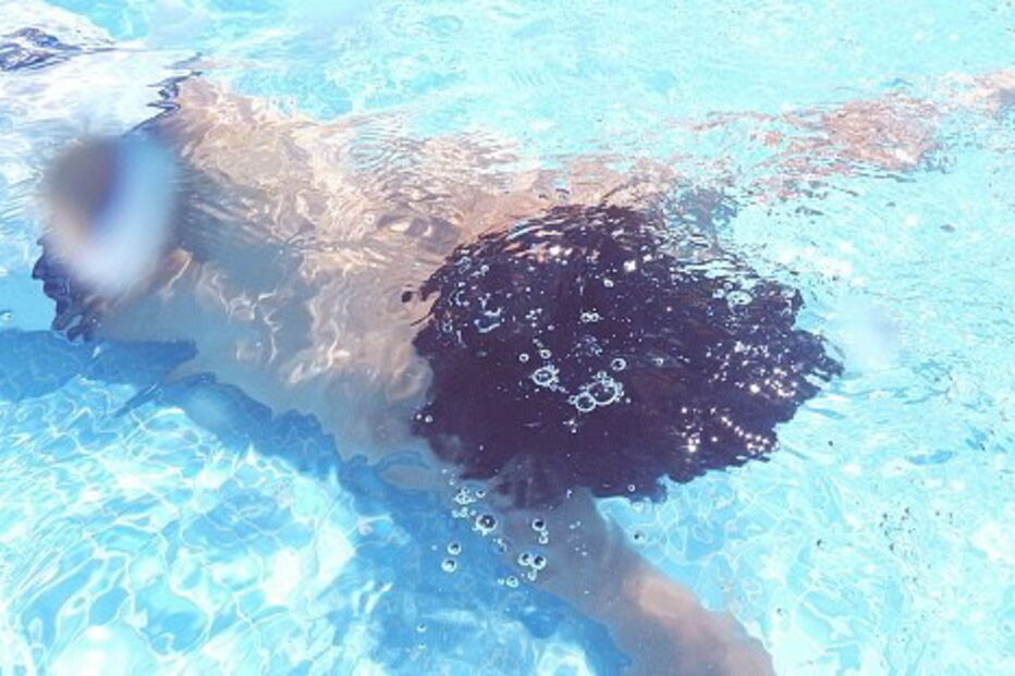 Sistema de limpeza da piscina sugou parte dos intestinos de criança de 14 anos, depois de brincadeira que correu mal