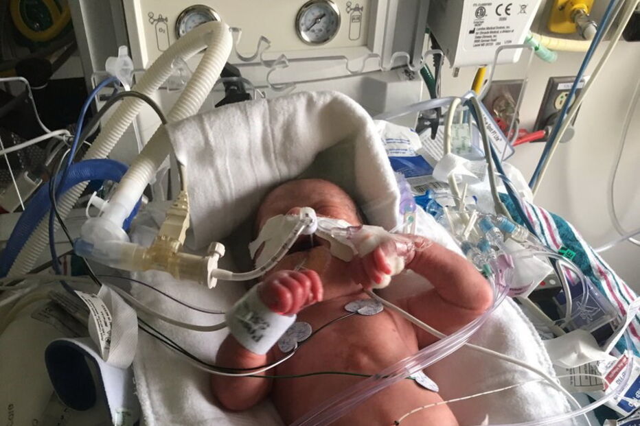 Shannon Macleod morreu, mas os médicos conseguiram salvar-lhe o sétimo filho, Joseph