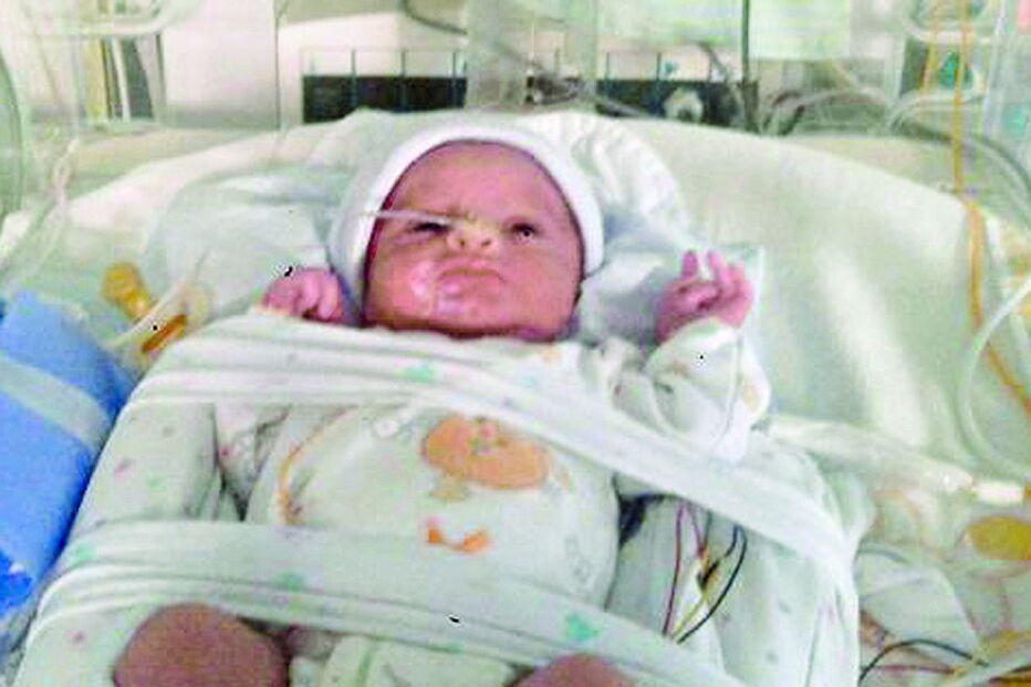 Lourenço dias após o nascimento