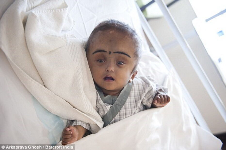 Roona Begum já tinha sido operada várias vezes