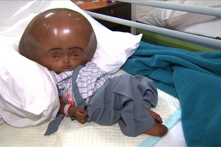 Roona Begum já tinha sido operada várias vezes