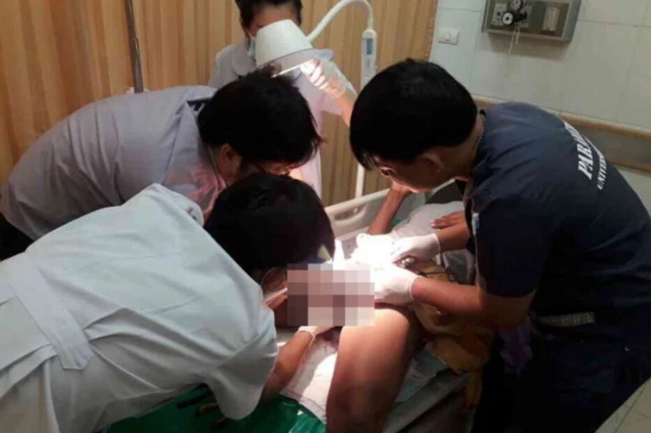 Wirat, Pattaya, Tailândia, Hospital, questões sociais, pénis, anéis, metal, órgão sexual