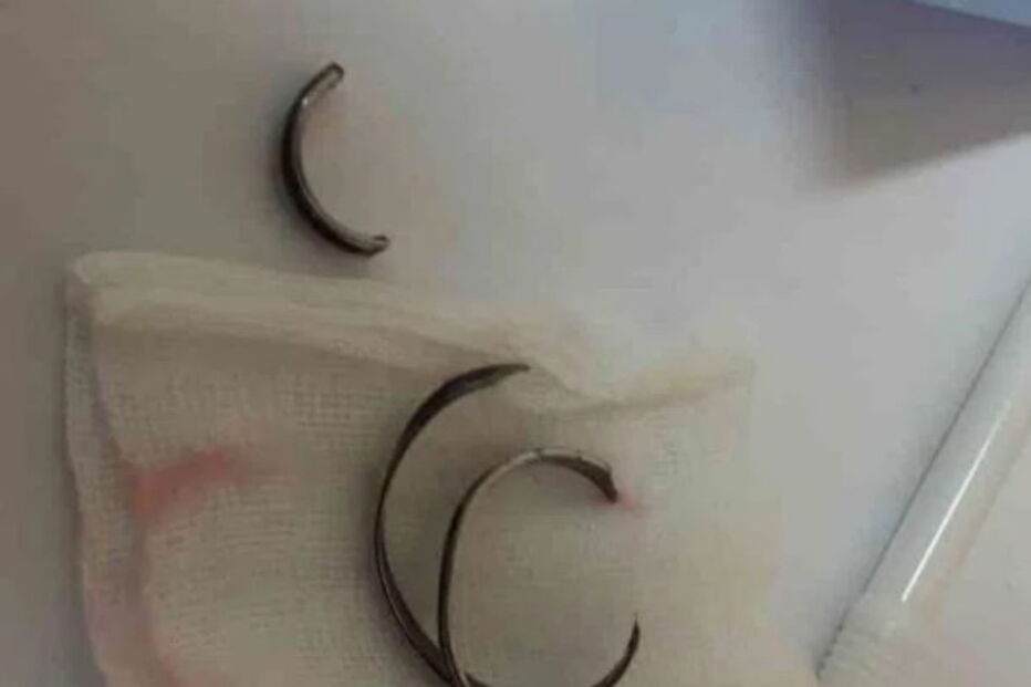 Wirat, Pattaya, Tailândia, Hospital, questões sociais, pénis, anéis, metal, órgão sexual