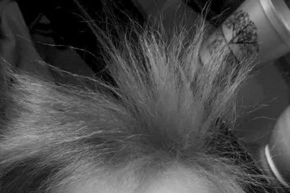 Menina com síndrome de cabelo despenteado 