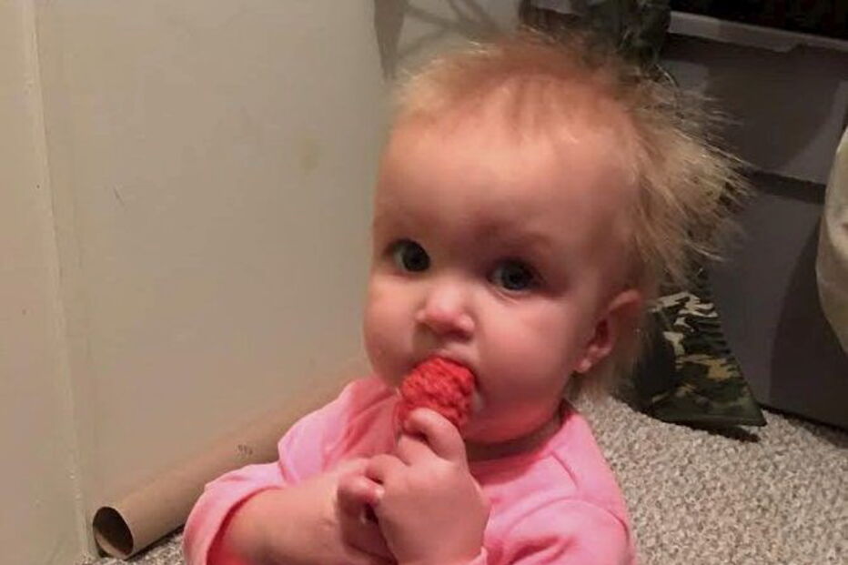 Menina com síndrome de cabelo despenteado 