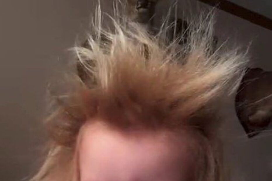 Menina com síndrome de cabelo despenteado 