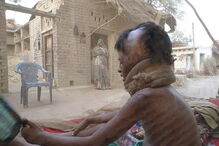 Julie, de 7 anos, foi agora ajudada pela Fundação Chhanv