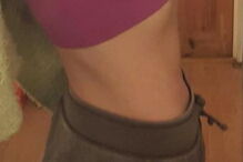 Mulher com endrometriose 