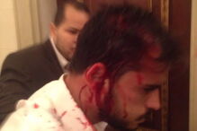 Deputado Armando Varas ficou ferido