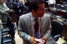 Venezuela, feridos, manifestação, parlamento, Nicolás Maduro 