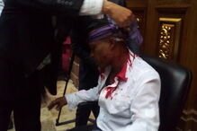 Venezuela, feridos, manifestação, parlamento, Nicolás Maduro 