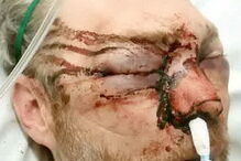 Professor atacado por ex-aluno