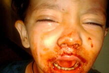 Os médicos acreditam tratar-se de uma condição raríssima.