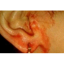 Os médicos acreditam tratar-se de uma condição raríssima.