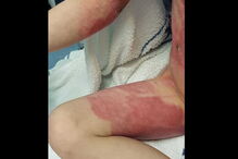 2017-07-09_15_46.03 queimado 1.PNG