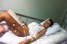 Ex-miss bumbum em tratamentos